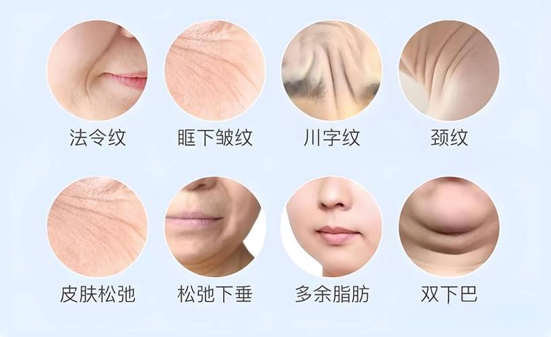 日照皮肤管理:自然光与护肤的完美邂逅